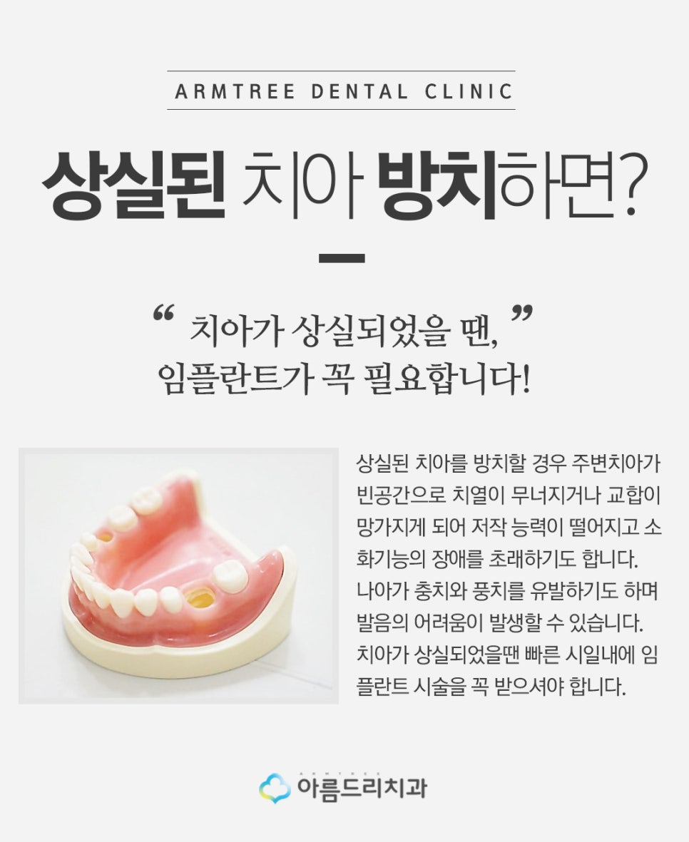 인플란트통증 네비게이션인플란트 걱정없음 관련 이미지 3