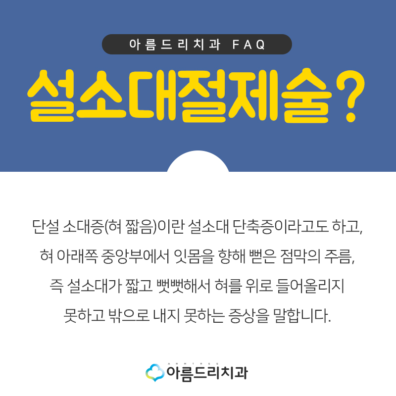 성인설소대수술 혀유착증 강남 바로알기 관련 이미지 6