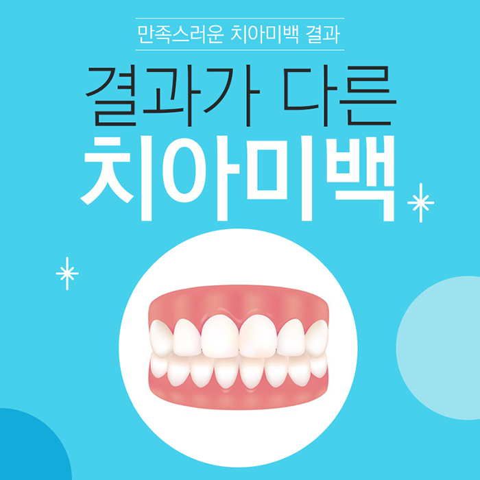 이빨미백 치과치아미백 결과의 차이 관련 이미지 1