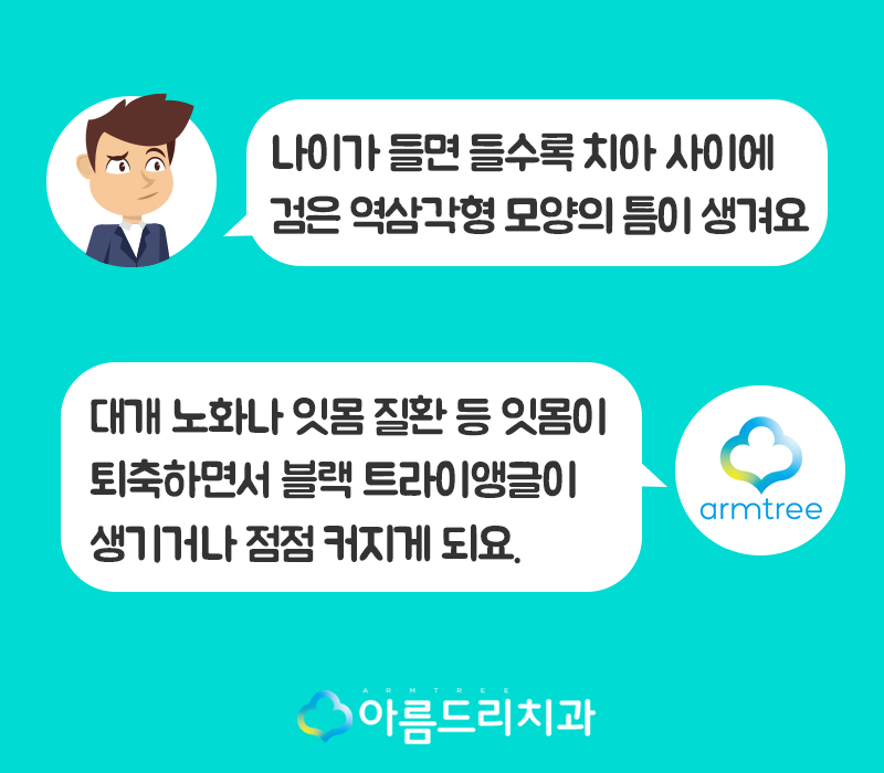 앞니 블랙트라이앵글 치아 이성형으로 해결 관련 이미지 2
