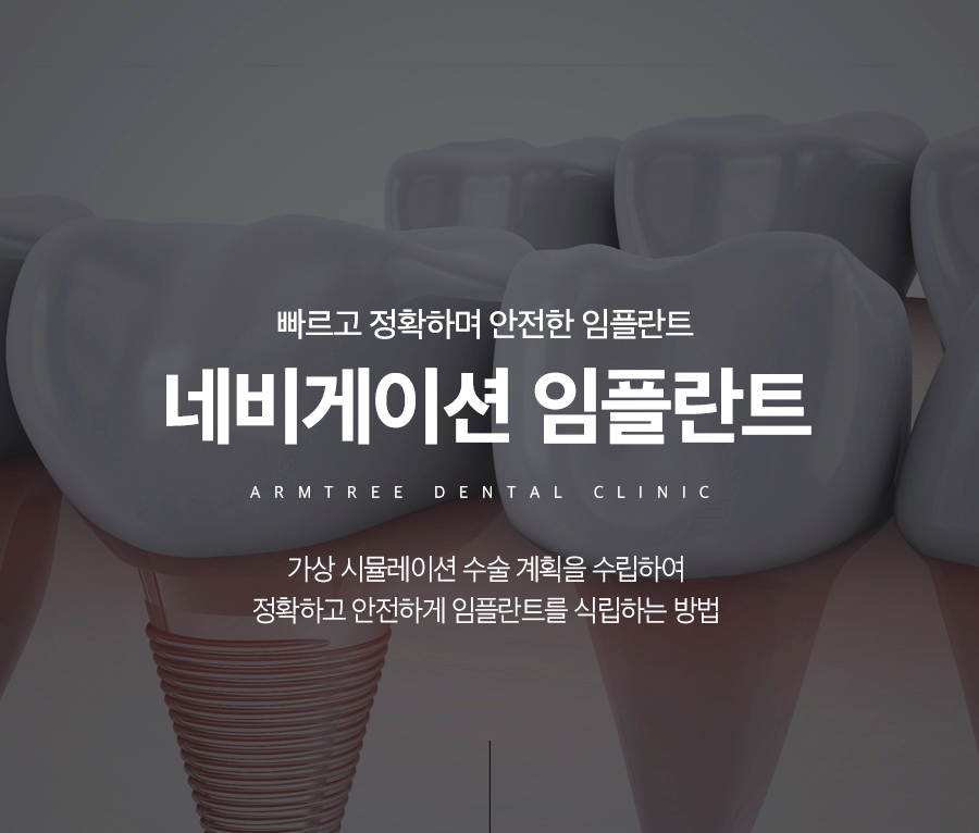 임플란트종류 오래쓰는 선택은 관련 이미지 1