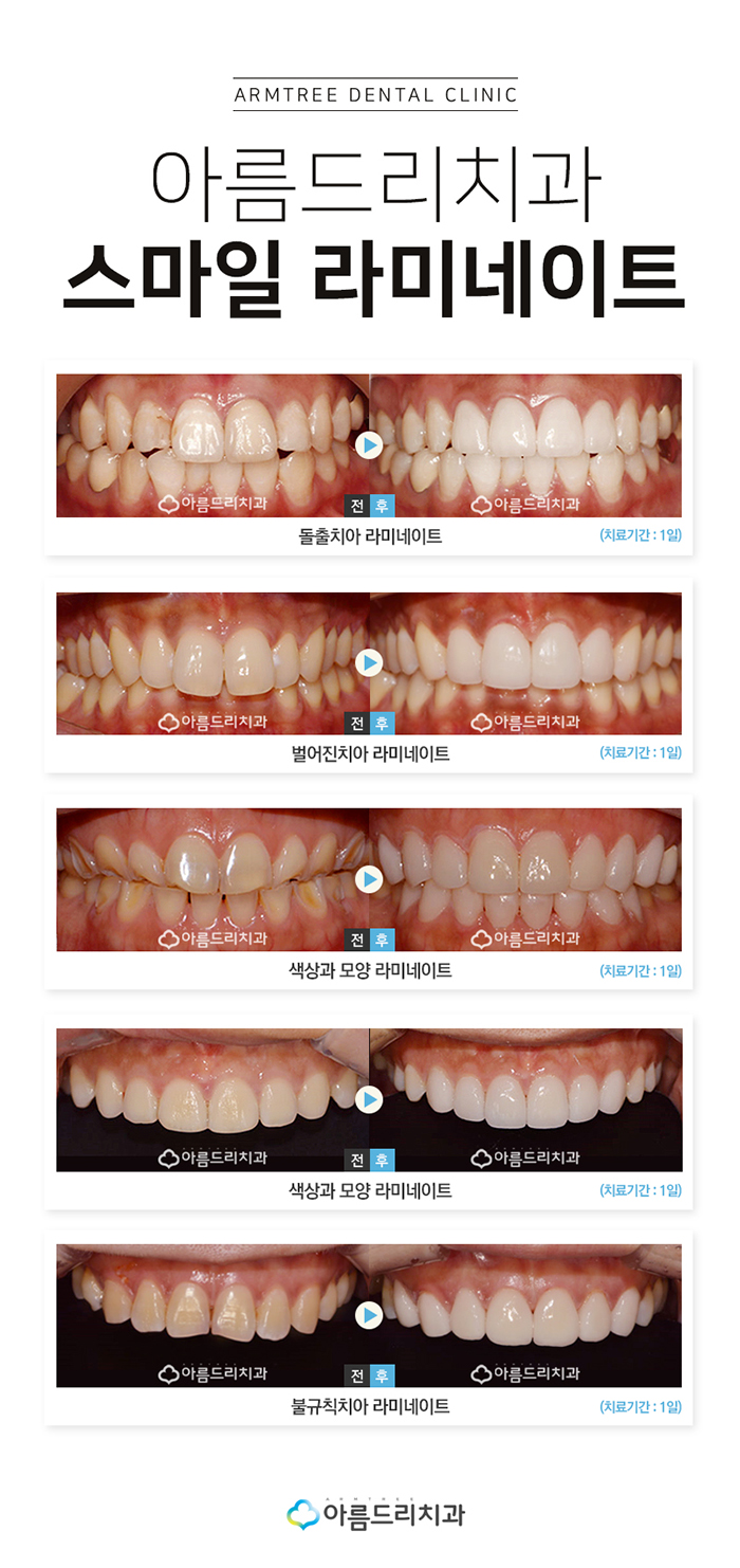무삭제라미네이트 속지말자 관련 이미지 7