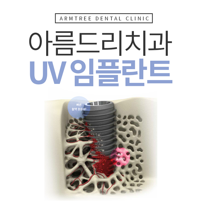 UV임플란트 역시 아름드리 관련 이미지 1