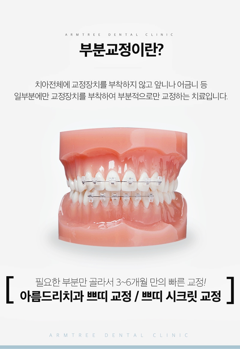 돌출앞니부분교정은 신논현역 아름드리치과에서 관련 이미지 4