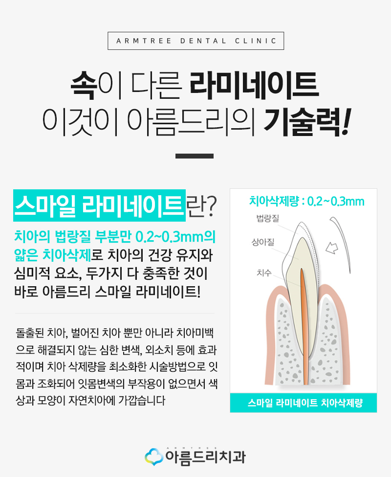 앞니 블랙트라이앵글 치아 이성형으로 해결 관련 이미지 9