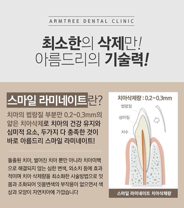 라미네이트교정 더이상 속지마 관련 이미지 4