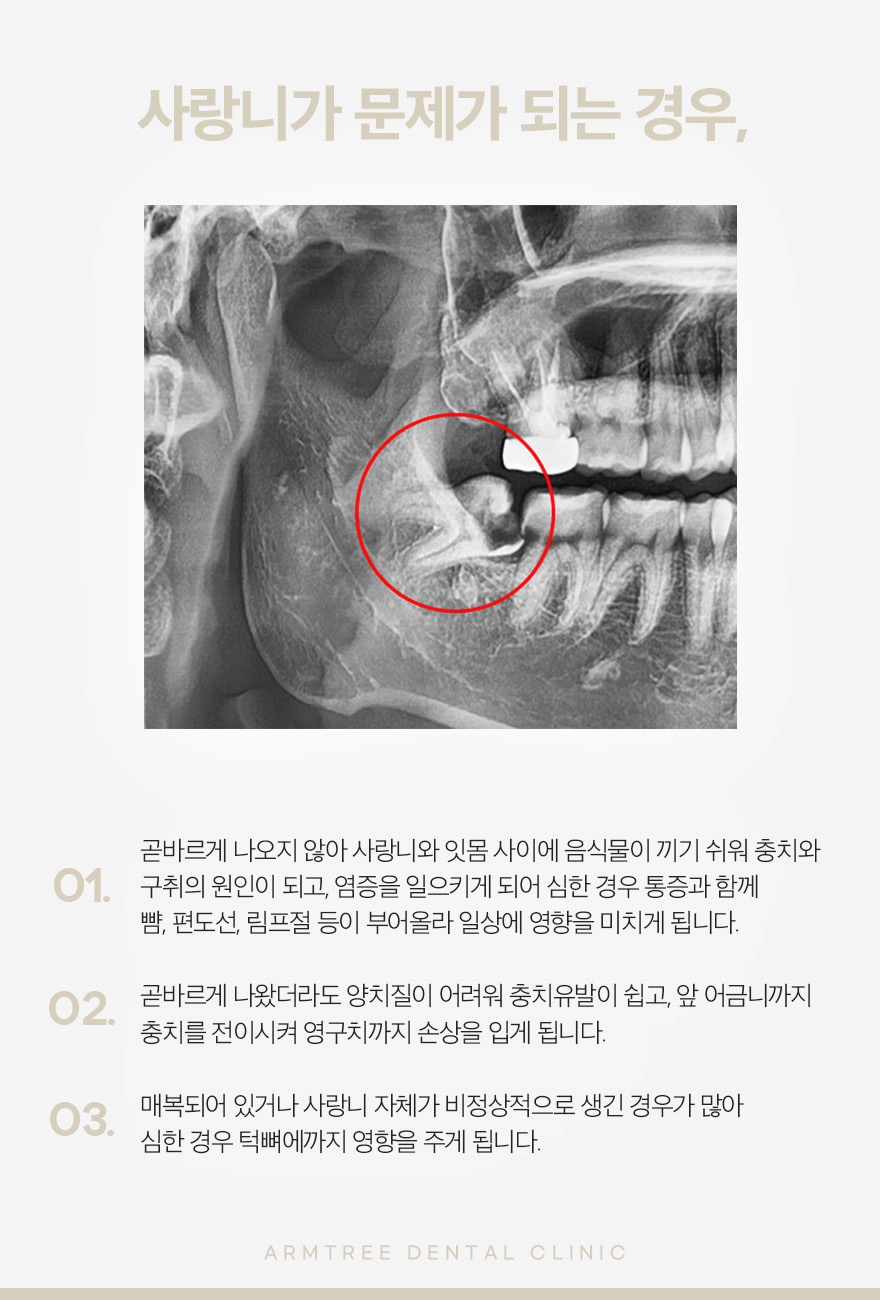 신논현역 사랑니발치는 체계적인 아름드리치과 관련 이미지 4