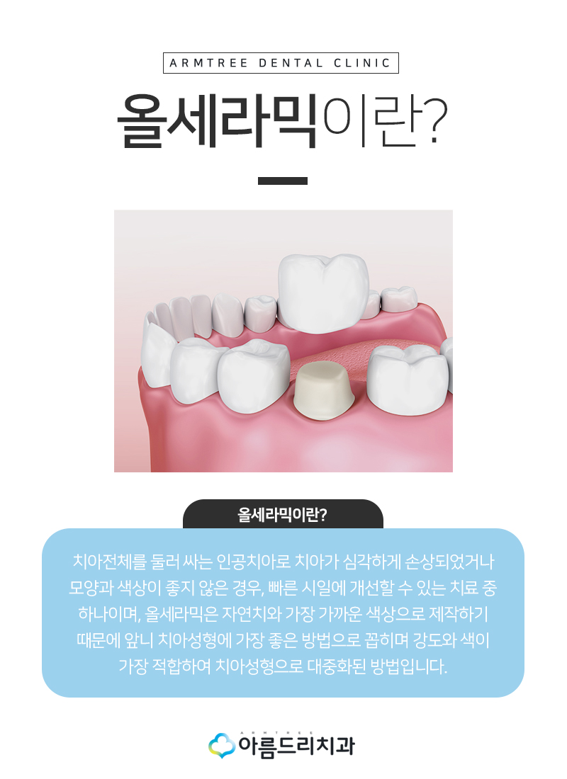 치아보철치료 앞니보철 후기 과연 관련 이미지 6