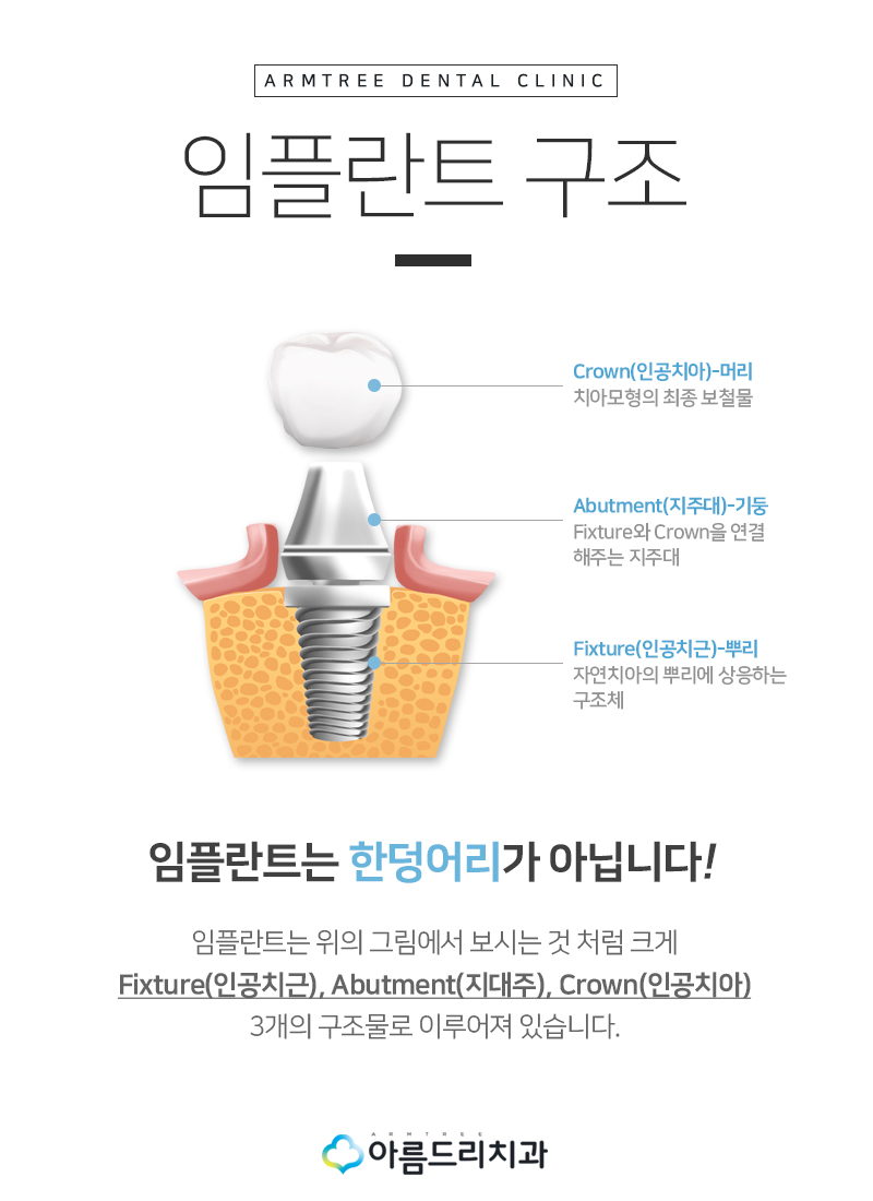 치아탈구(깨짐) 앞니임플란트 지르코니아어버트먼트 관련 이미지 5