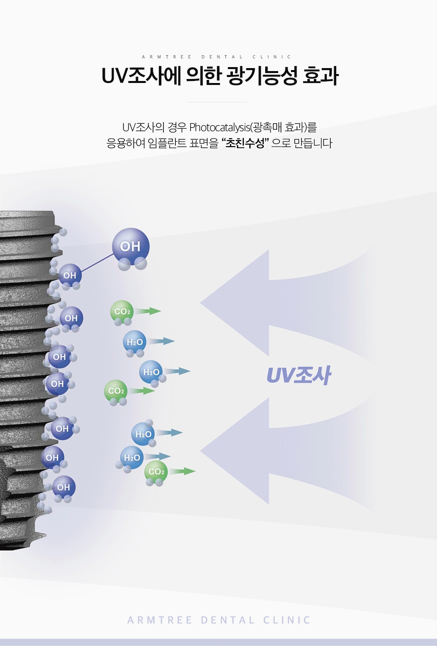 UV임플란트 정확한 아름드리치과 관련 이미지 5