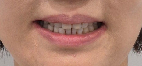 테일러 비니어 (진료일기) 관련 이미지 14