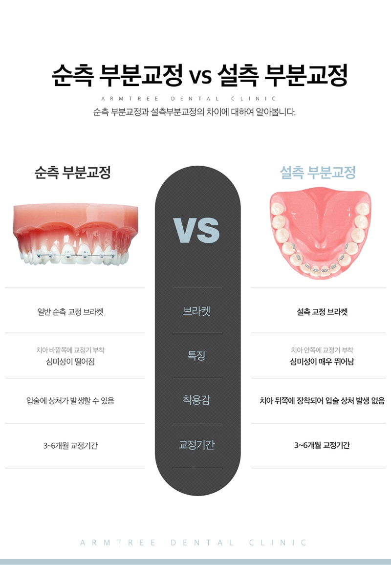 벌어진앞니부분교정 신논현역 아름드리치과 관련 이미지 6