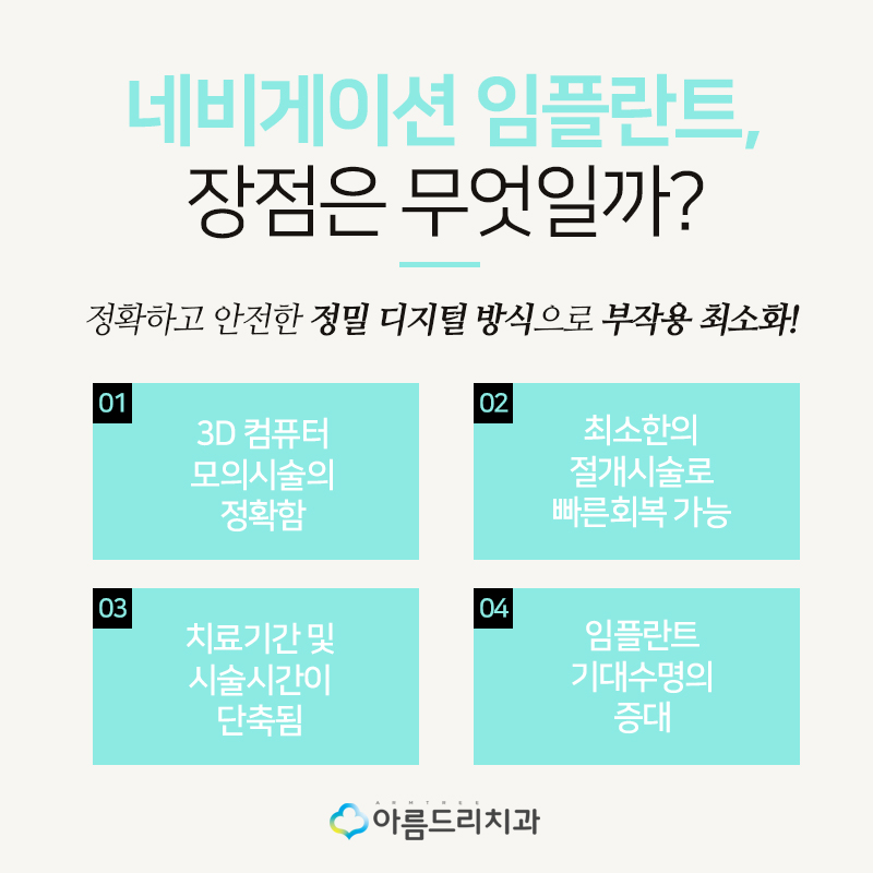 네비게이션 인플란트 기간은 어떻게? 관련 이미지 7