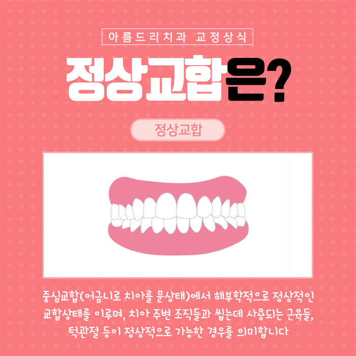 치아부정교합교정 원인과 예방법 관련 이미지 4