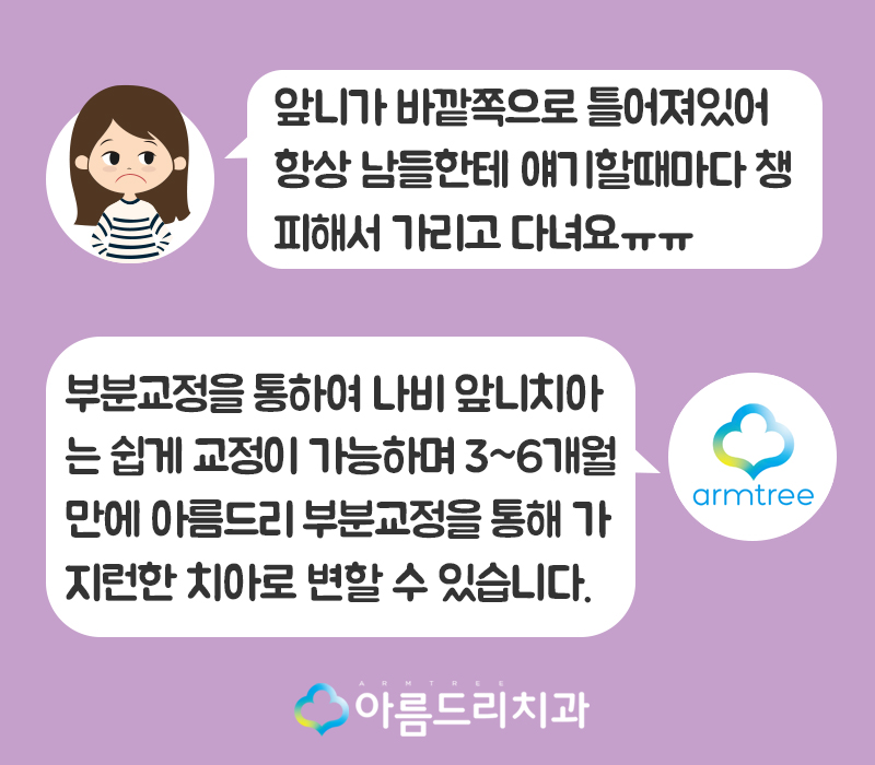 나비치아 교정 앞니 부분교정 후기 관련 이미지 2
