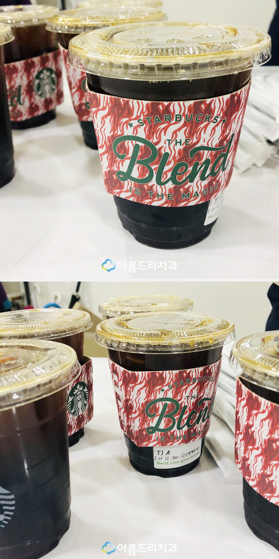 클리피씨교정기간 치아교정통증 없는 환자선물 관련 이미지 3