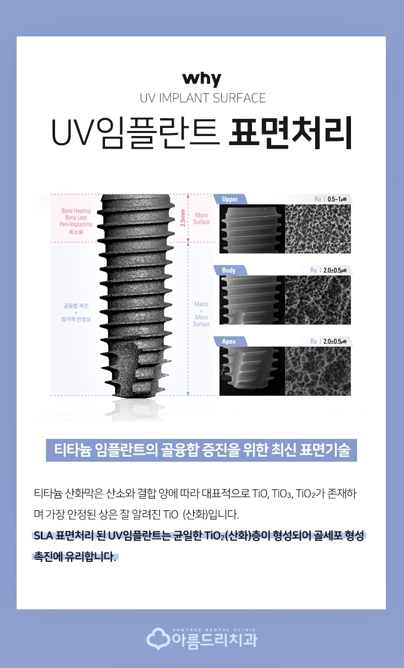 UV임플란트 - 골형성 유착능력 향상 관련 이미지 5