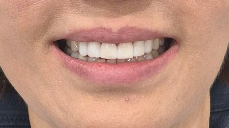 테일러 비니어 (진료일기) 관련 이미지 9