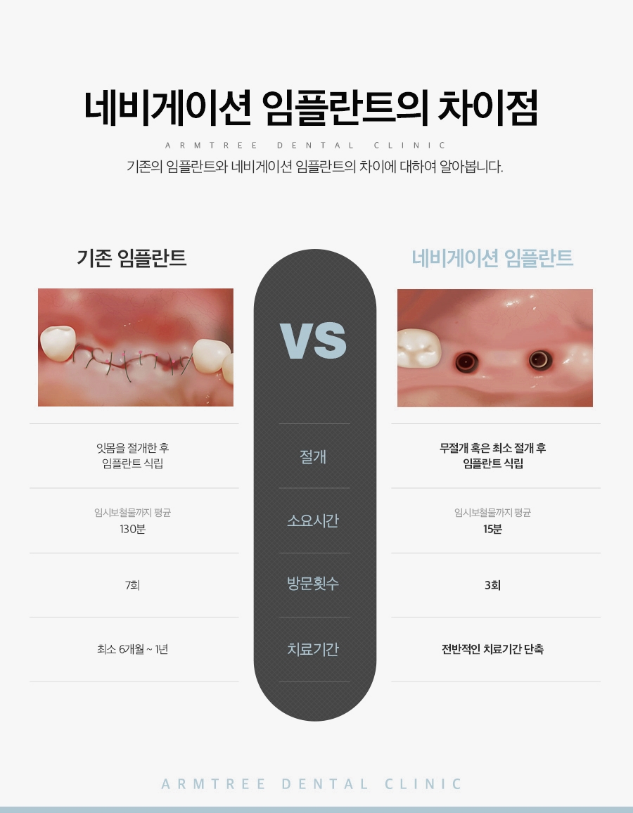 앞니임플란트 만족도 신논현역 아름드리치과 관련 이미지 4