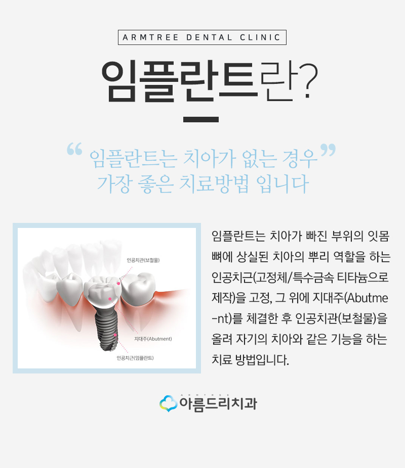 컴퓨터분석 디지털임플란트 어떨까? 관련 이미지 2