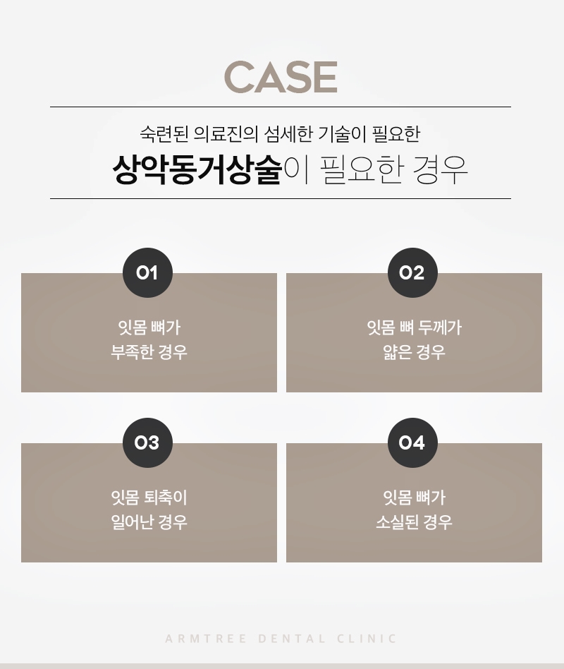 신논현역 상악동거상술 임플란트 아름드리치과는 관련 이미지 6