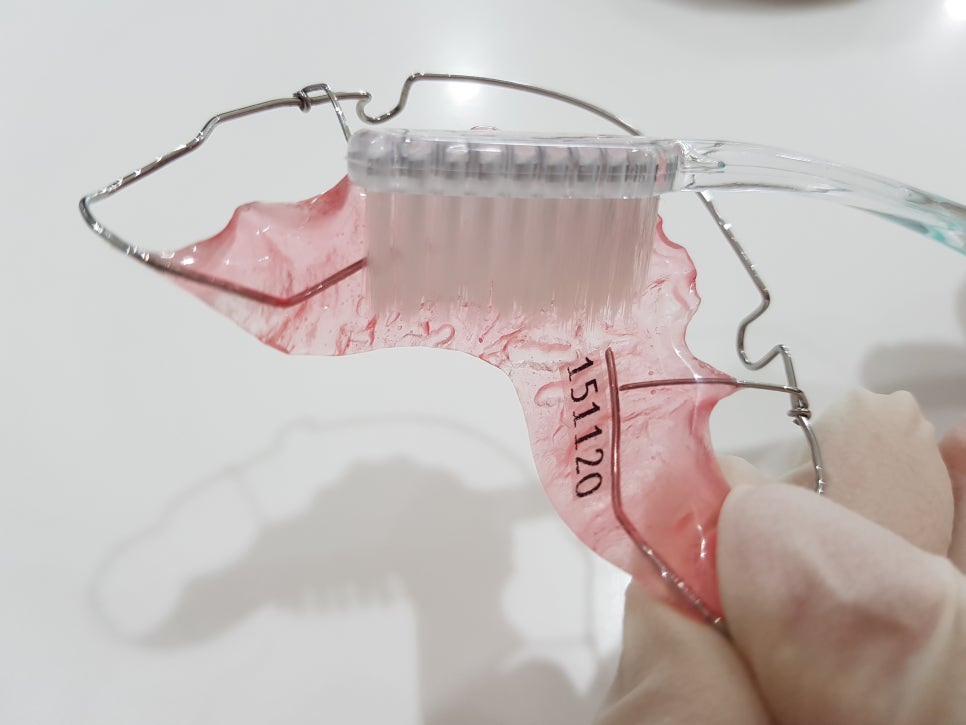 치아교정 후 유지 장치 세척&관리법 Tip_강남 아름드리 치과 관련 이미지 13