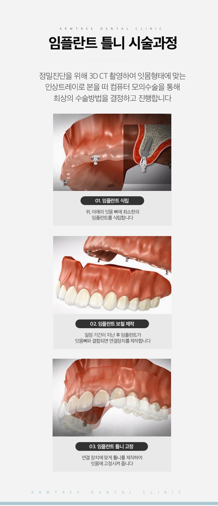 임플란트틀니 정직한 신논현역 아름드리치과 관련 이미지 5