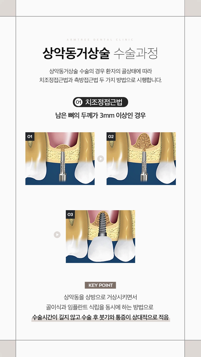 신논현역 상악동거상술 임플란트 아름드리치과는 관련 이미지 4