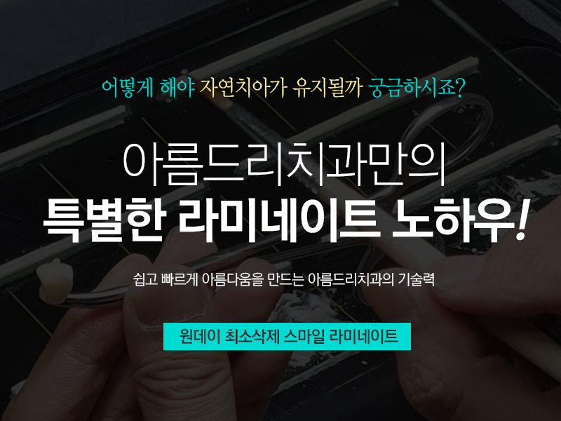 아름드리치과 속이다른 스마일라미네이트 관련 이미지 4