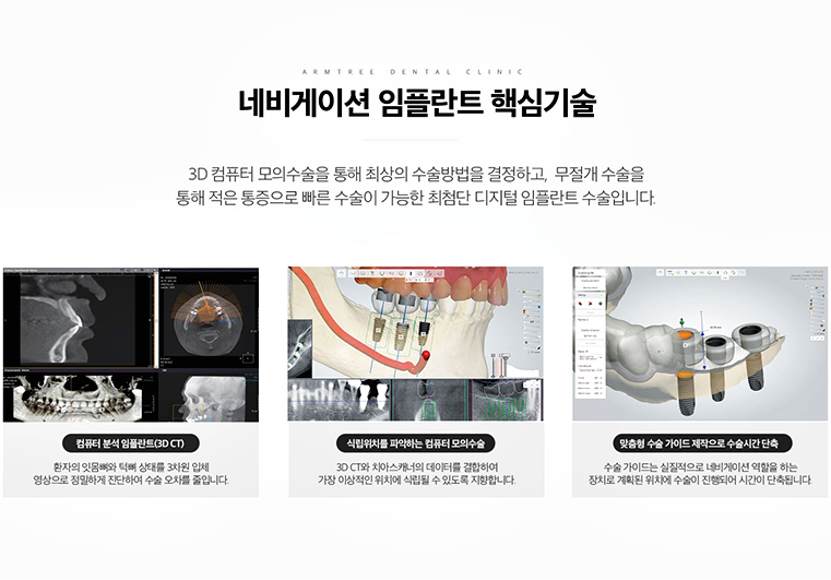 아름드리치과 임플란트의 안전성과 정확성을 높이다 관련 이미지 6