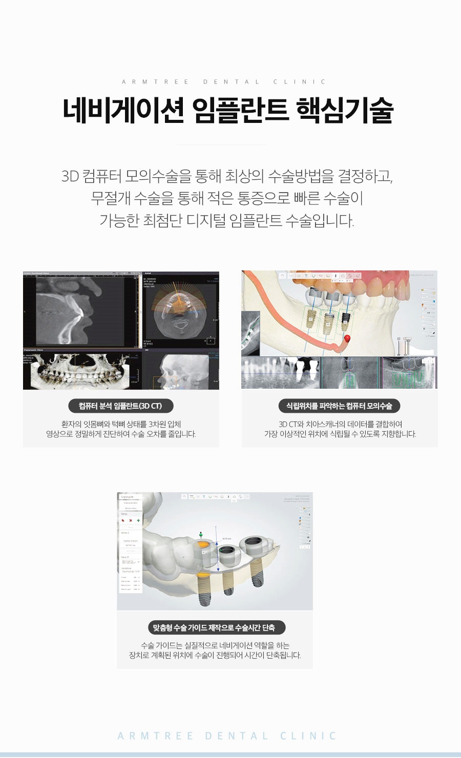 컴퓨터분석임플란트 아름드리치과의 네비게이션이 정답! 관련 이미지 5