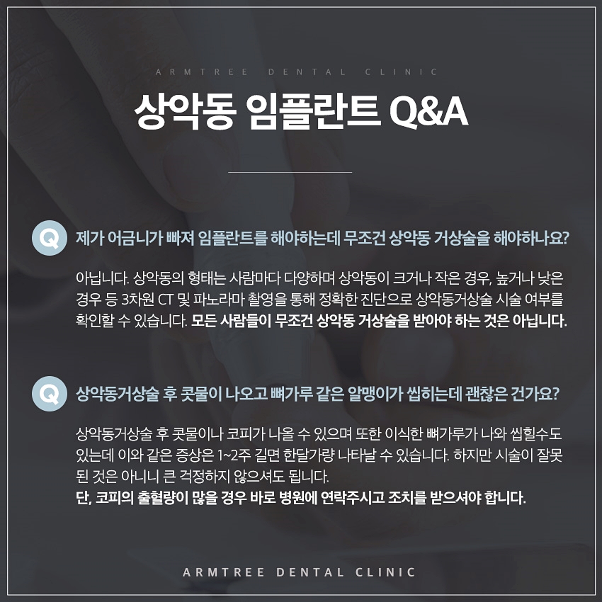 상악동거상술 부작용없는 아름드리치과 관련 이미지 8