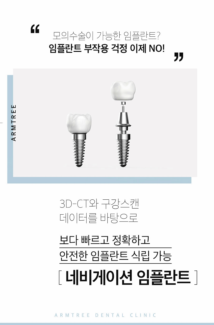 네비게이션임플란트가격 컴퓨터분석 신논현역치과 관련 이미지 2