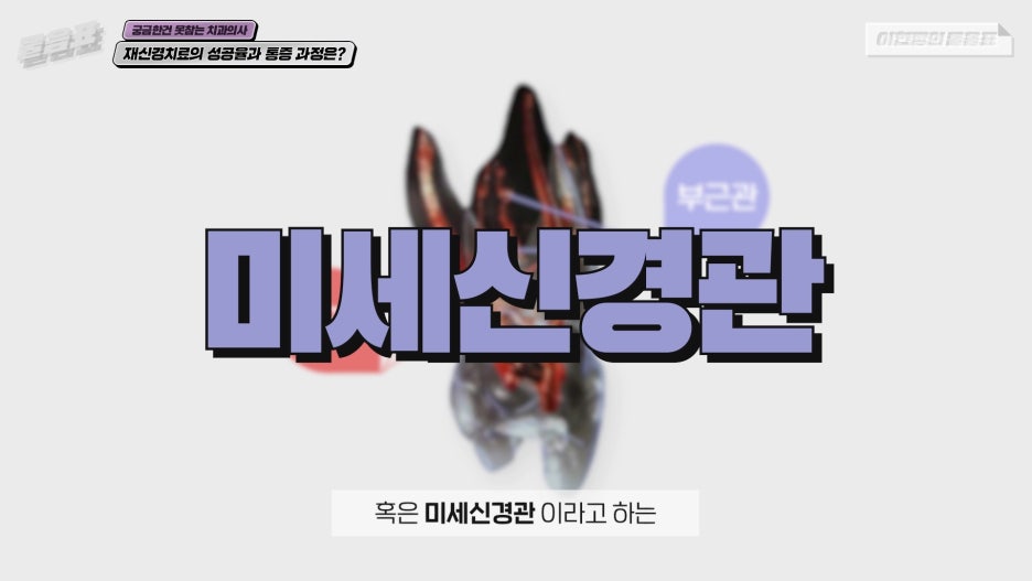 치아 재신경치료 성공율 과정과 통증 #이현정의물음표 관련 이미지 5