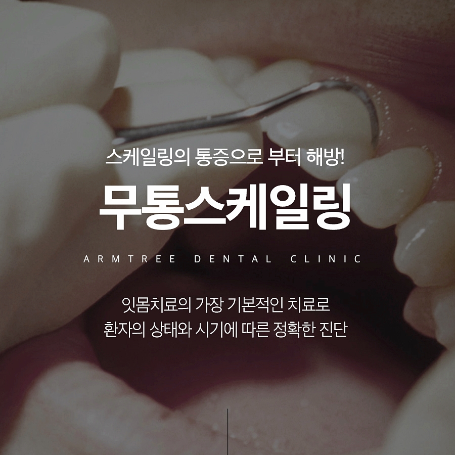 무통스케일링으로 치과공포증 극복하기 관련 이미지 1