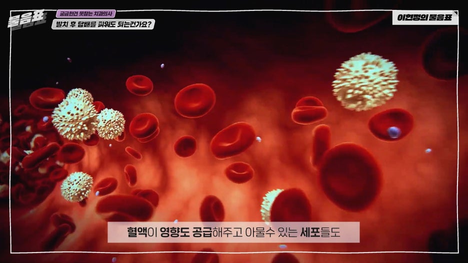 발치 후 흡연 안되는 이유? 치아상식 이현정의물음표 관련 이미지 6
