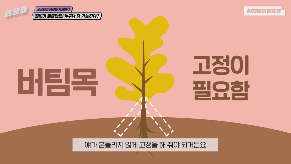 원데이임플란트 누구나 가능하다? #이현정의물음표 관련 이미지 12