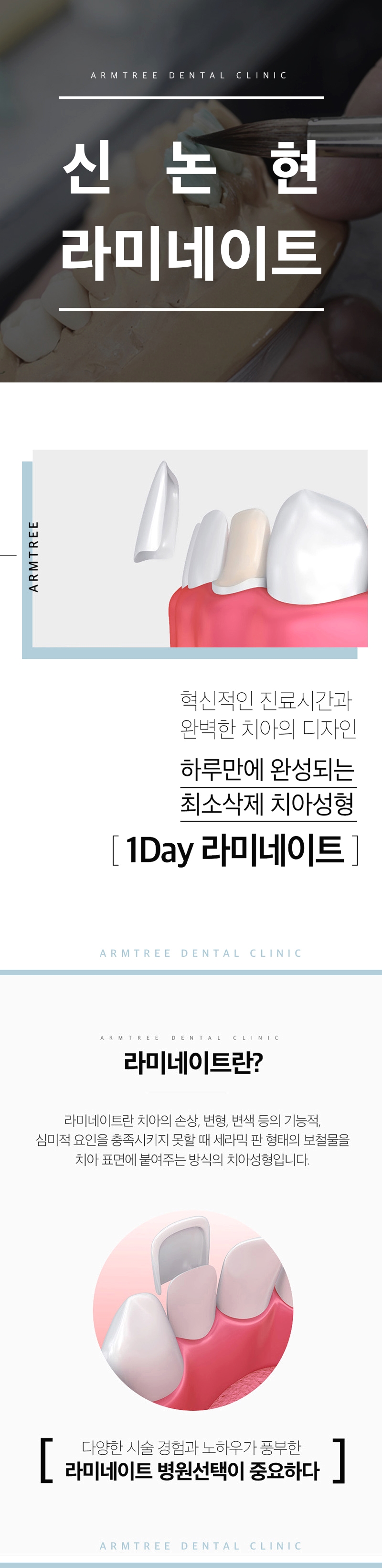 신논현라미네이트 심미성과 치아건강을 한번에 관련 이미지 1