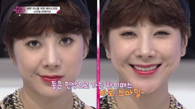 이현정 원장의 스마일 트레이닝-sbs  서인영의 스타 뷰티쇼 시즌 4(예쁜 미소를 위한 페이스 코칭) 관련 이미지 7