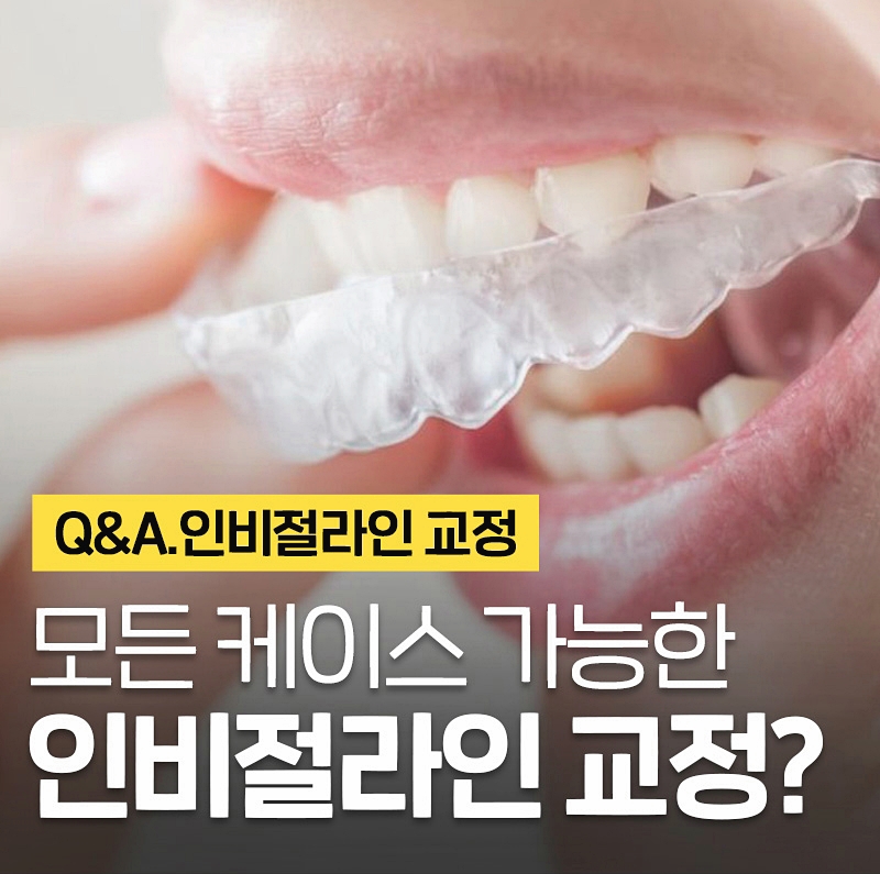 인비절라인교정 모든치아에 가능하다? 치아상식 이현정의물음표 관련 이미지 1