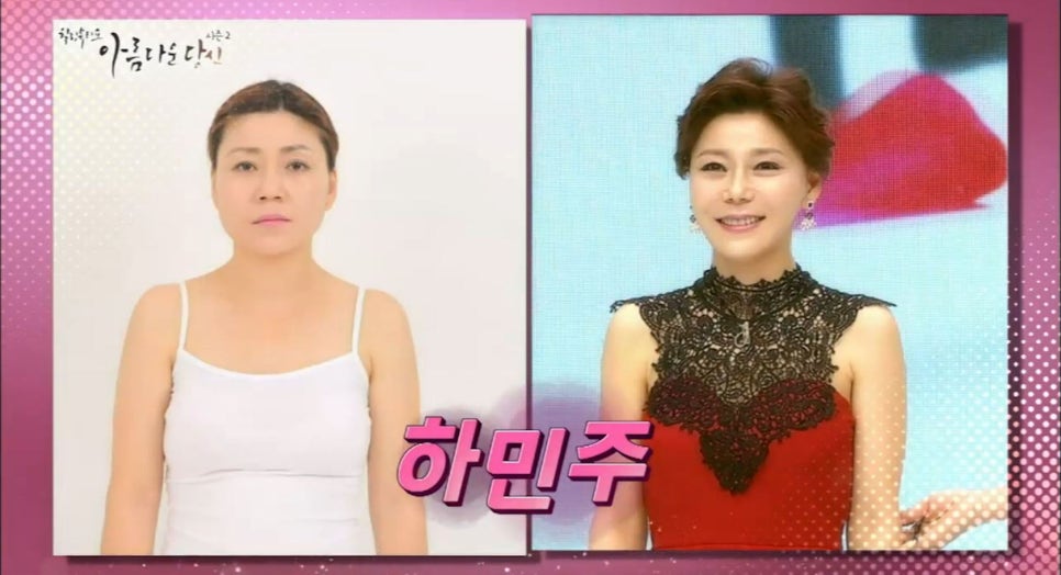 이현정원장의 아름다운 당신 시즌 2(1회 하민주 도전자) 치아 고민 해결 관련 이미지 3