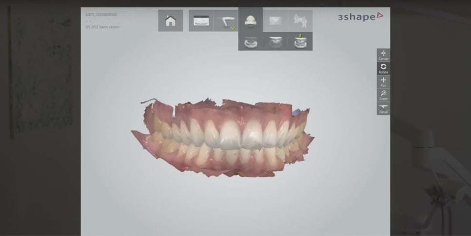 아름드리치과 이현정원장의 치료 이야기- 라미네이트란? 관련 이미지 12