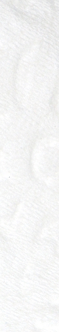 신논현치과 사랑니발치 치과는 신중하게 관련 이미지 5