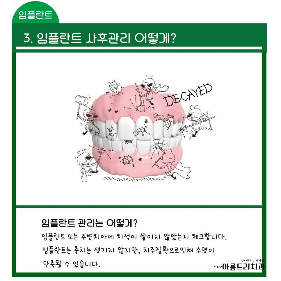 신논현역 치과_임플란트 지켜야 할 주의사항!!!_아름드리 치과 관련 이미지 5
