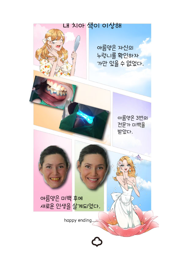 치아미백 꼭 알아야 하는 주의사항 확인하세요 관련 이미지 2