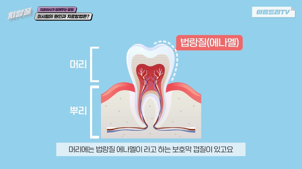 이가 시린이유 이가 시릴때 치료방법 아름드리치과 관련 이미지 2