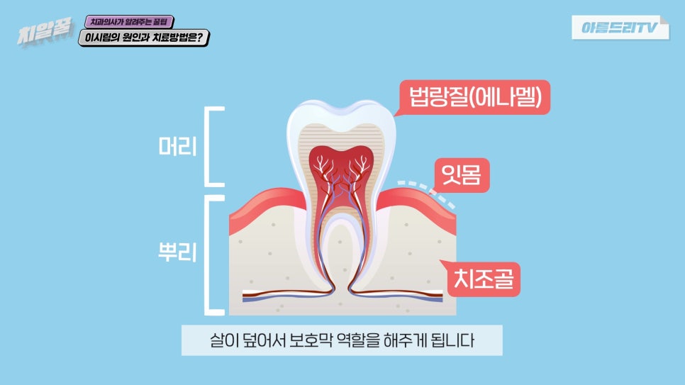 이가 시린이유 이가 시릴때 치료방법 아름드리치과 관련 이미지 3