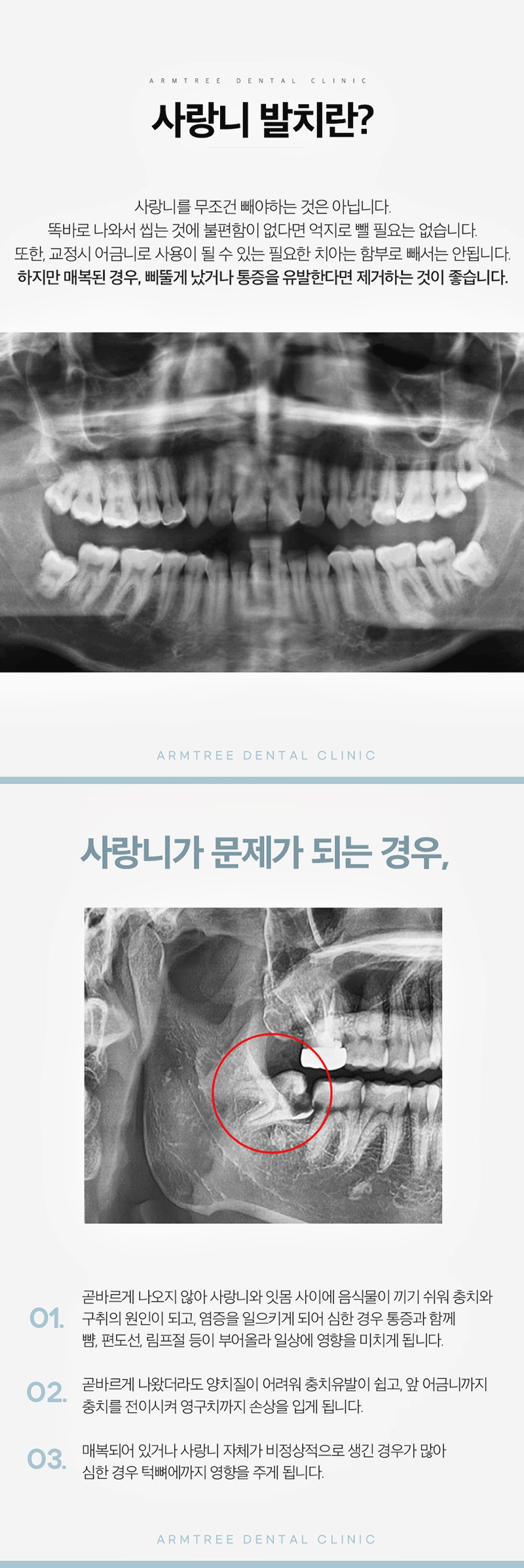 반포치과 사랑니발치 치과를 찾고있다면 관련 이미지 2