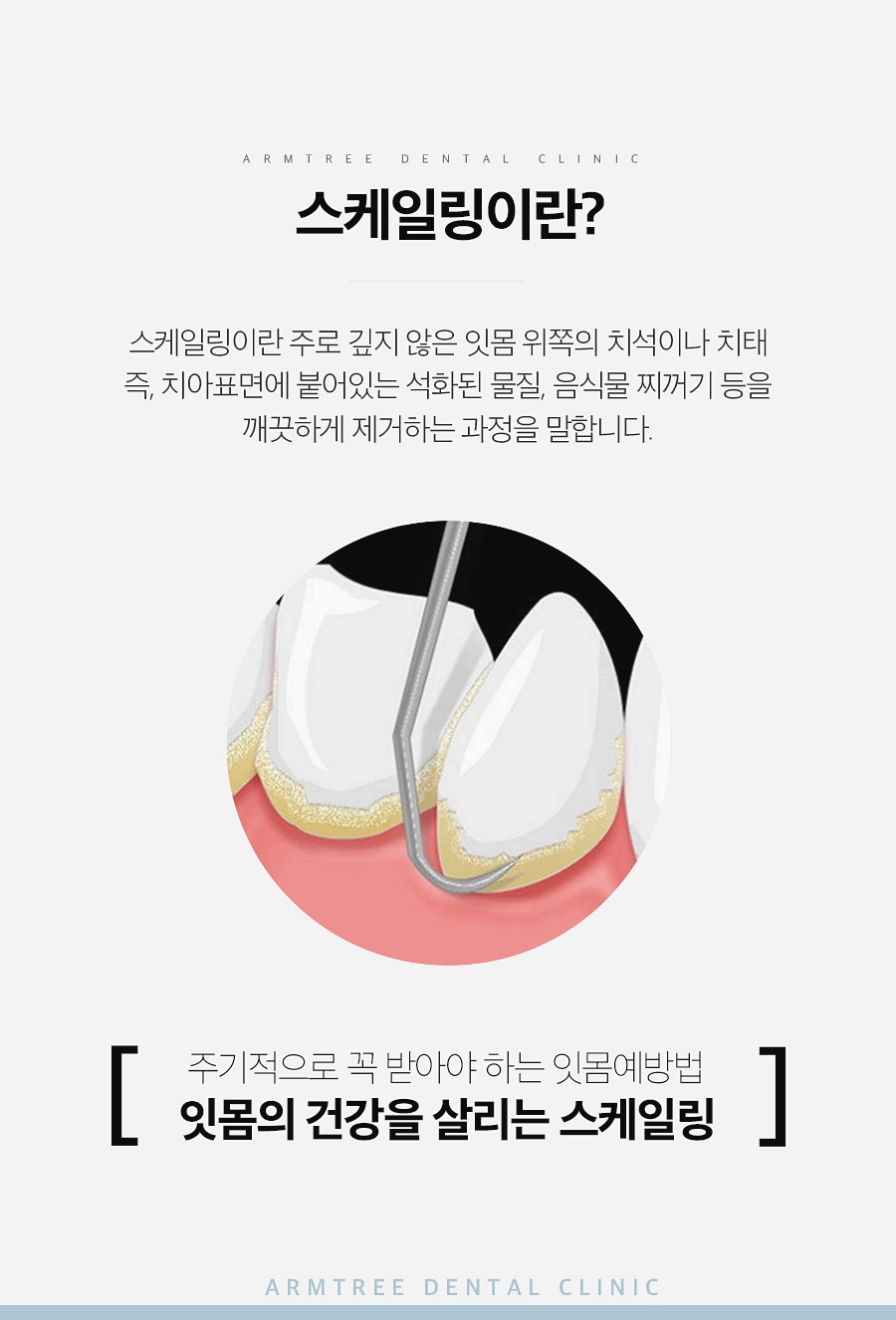 무통스케일링 안아픈치과 치과공포증 극복 아름드리치과 관련 이미지 4