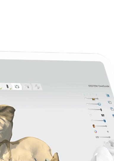 디지털임플란트 당일임플란트로 정확하고 안전하다면 관련 이미지 18